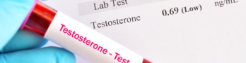 Buying Testosterone Online: Separating the Best from the Rest